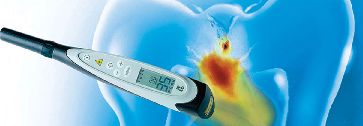 Un dentiste utilisant un appareil de fluorescence laser DIAGNOdent pour détecter les caries interproximales sur une dent d'un patient.