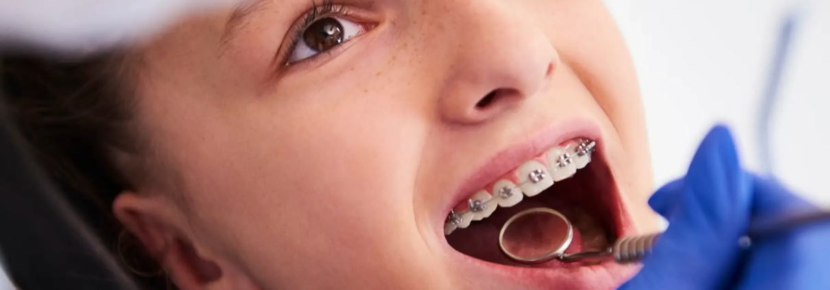 Enfant heureux lors d'une visite chez le dentiste, montrant l'importance du suivi professionnel pour le bien-être bucal et l'hygiène dentaire avec des appareils orthodontiques