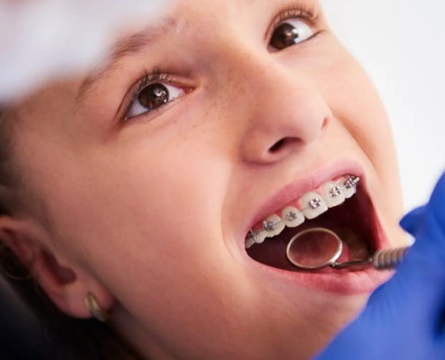 Enfant heureux lors d'une visite chez le dentiste, montrant l'importance du suivi professionnel pour le bien-être bucal et l'hygiène dentaire avec des appareils orthodontiques